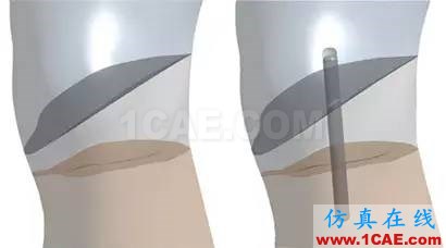 美國仿真專家首次利用ANSYS協助修復破損的雕塑ansys培訓課程圖片6